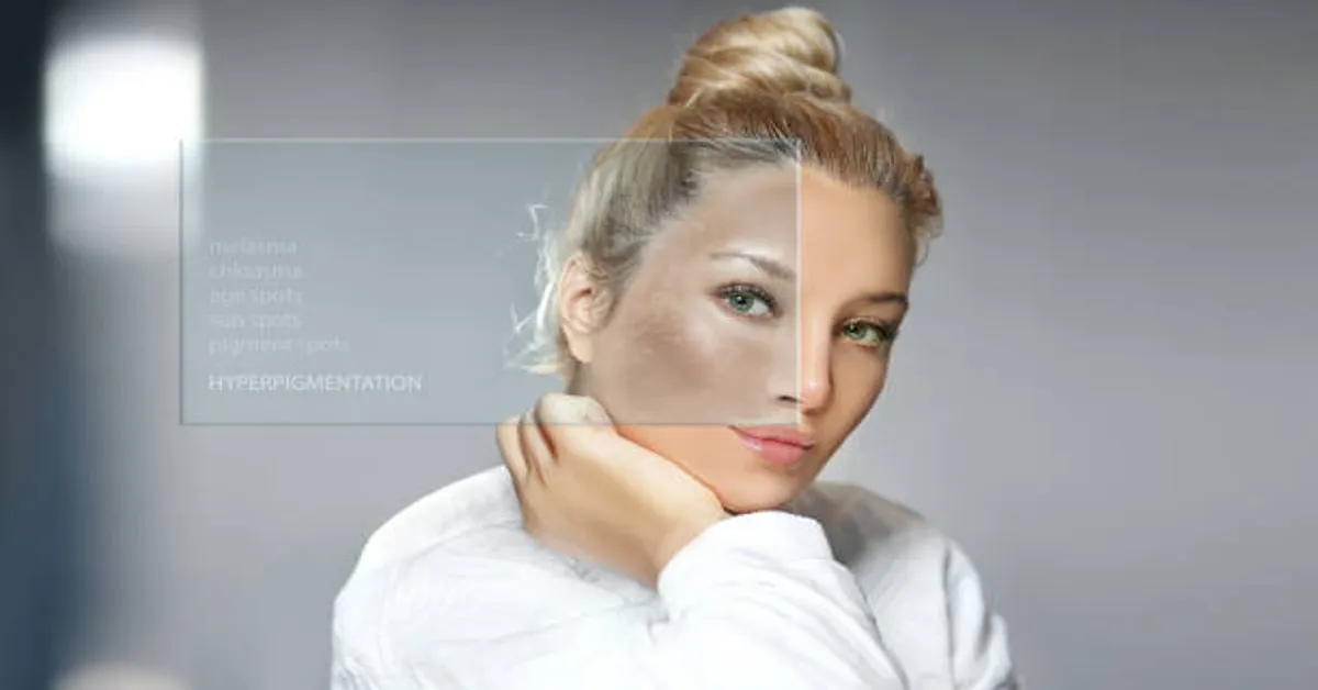 SkinPres T